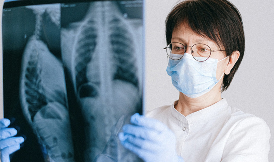 Nouveaux traitements du cancer du poumon en 2022