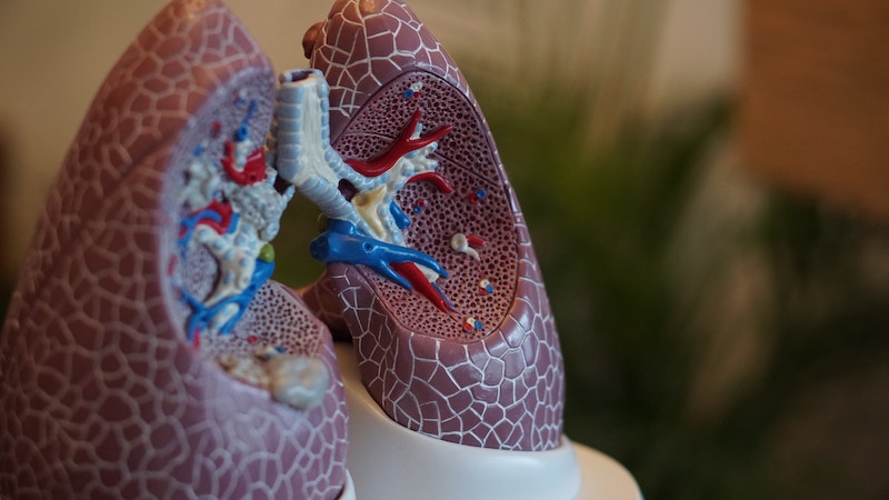 Le fruquintinib comme traitement du cancer du poumon : En sommes-nous encore là ?